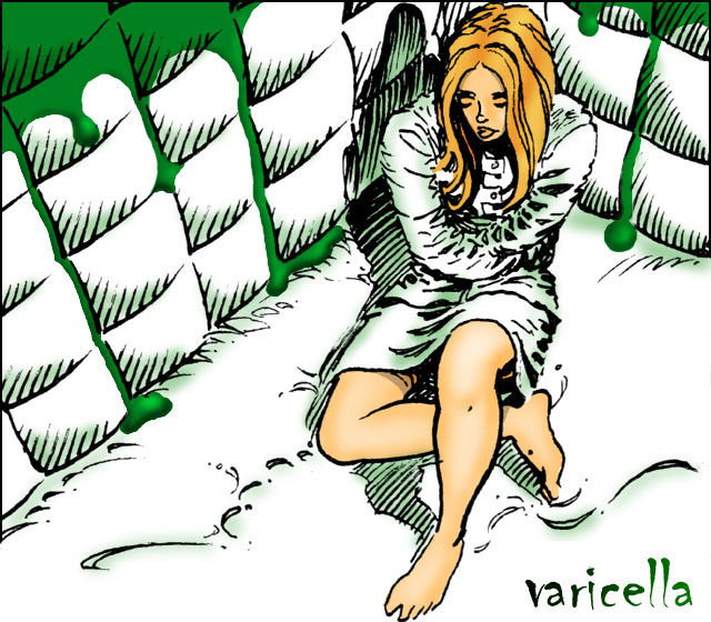 Varicella Varicella