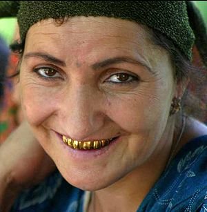 300px-tajikistan_gold_teeth.jpg